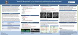 The Great Masquerader- A Case of Decreased Vision Secondary to Neurosyphilis